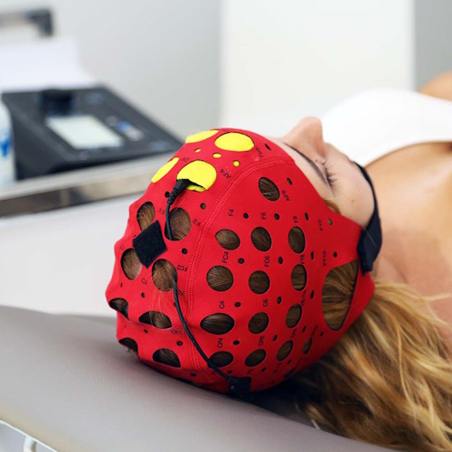 servicio de terapia transcraneal